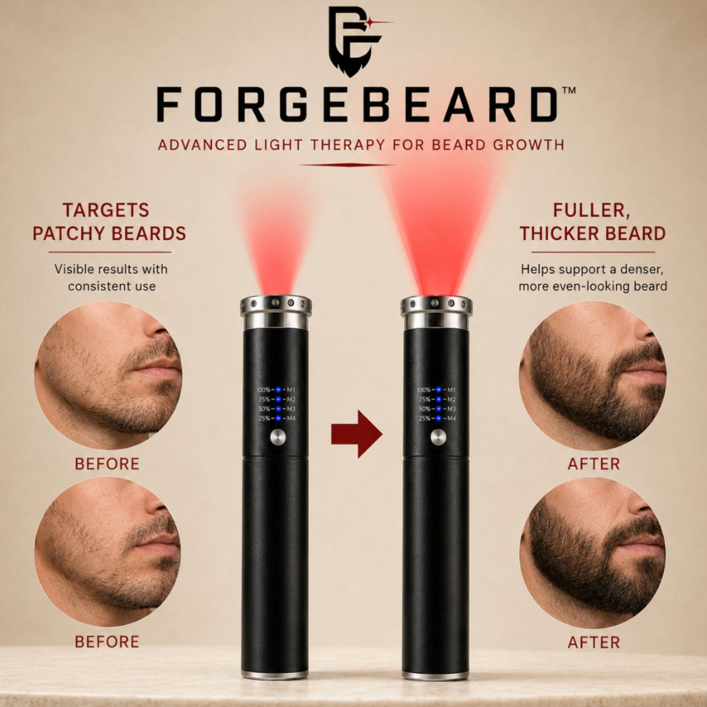 ForgeBeard™ Advanced Beard Therapy Device