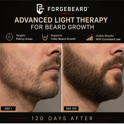ForgeBeard™ Advanced Beard Therapy Device
