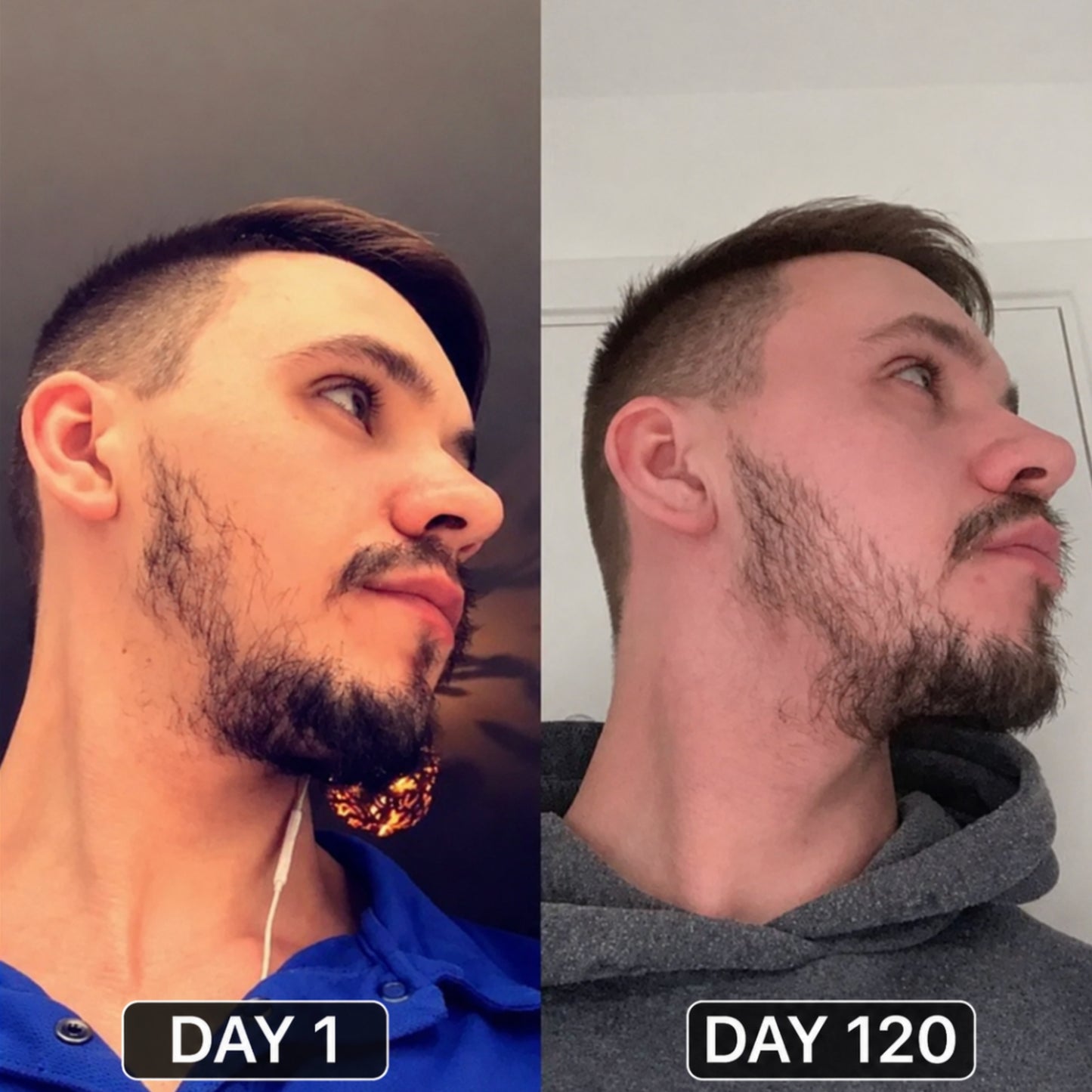 ForgeBeard™ Advanced Beard Therapy Device